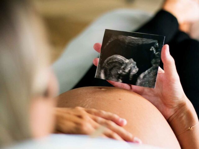 Cuidados para Gestantes com Doenças Reumáticas